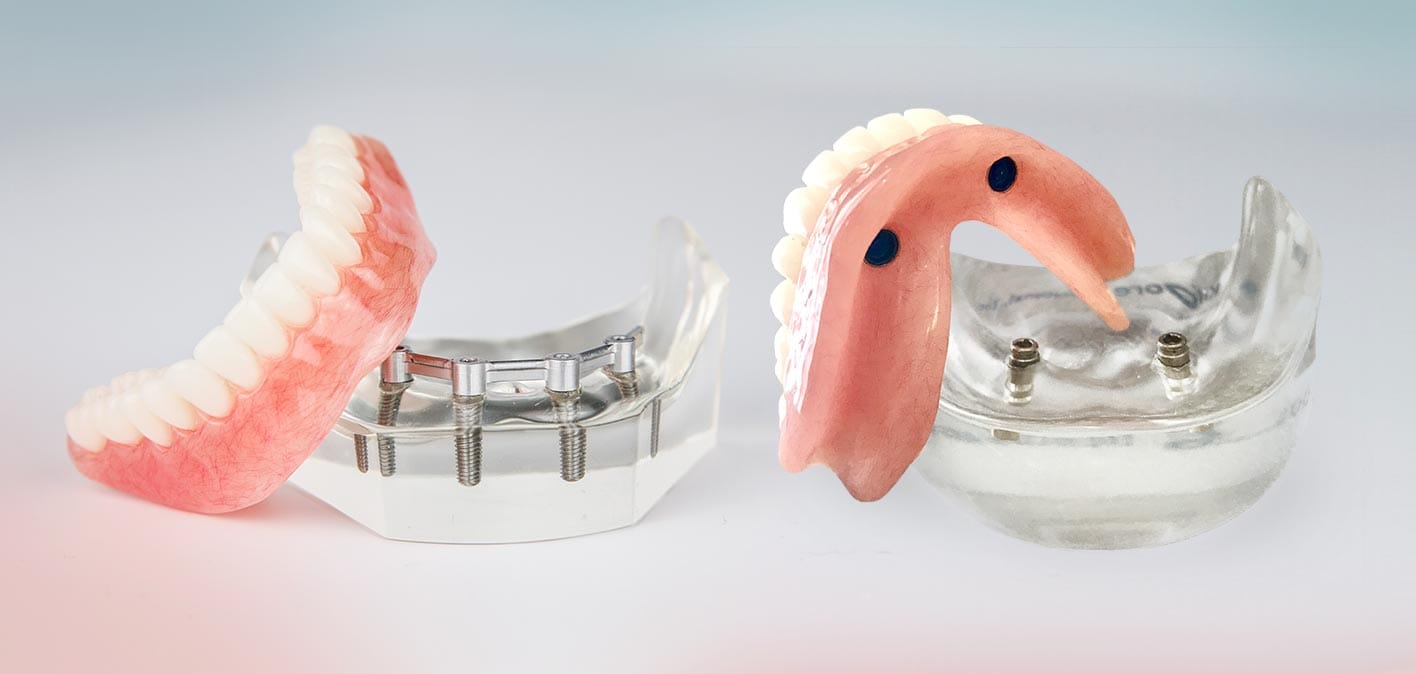 Implant supported ( This denture is fitted well in the mouth since the denture is supported by dental implants which is placed in to the jaw bone.)
