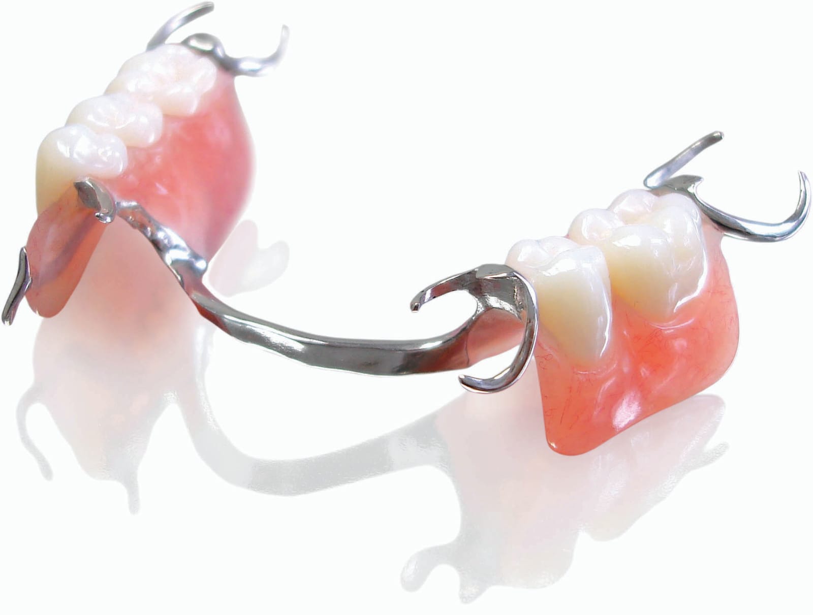 Metal dentures (Metal dentures have a great fit compared to acrylic dentures and it is more comfortable.This is economical way to replace missing teeth 
secured using metal clasps, pink acrylic gums and natural looking teeth.)